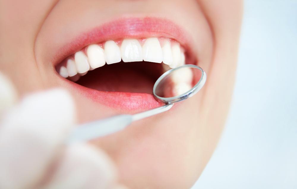 Close up of patients smile during cosmetic dentistry consultation in Winston Salem NC