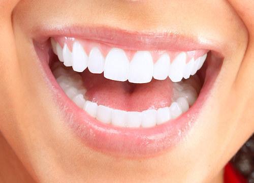 Close up of patients smile with dentures in Winston Salem NC