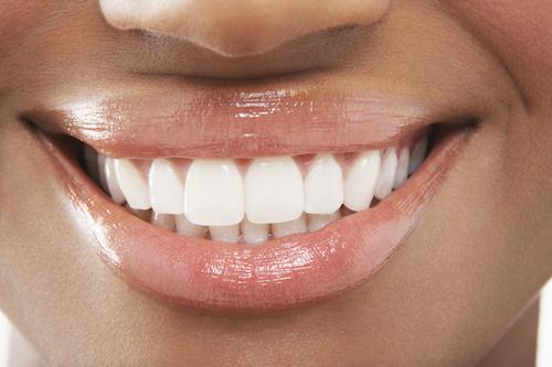 Close up of patients smile with dental fillings in Winston Salem NC