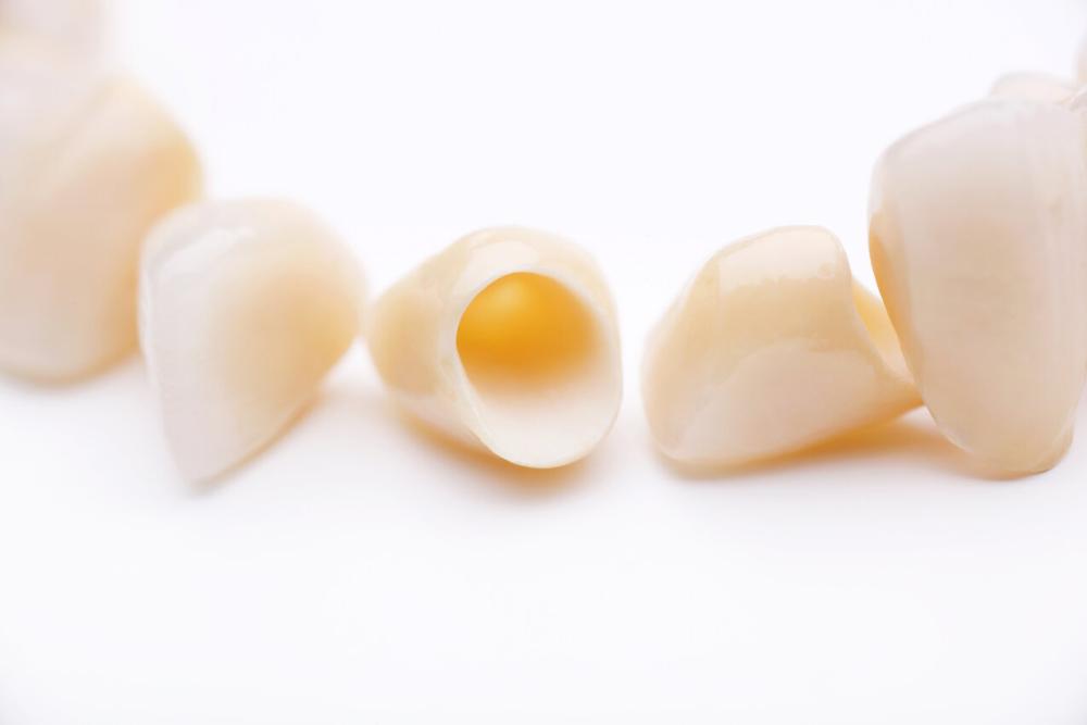 dental crowns