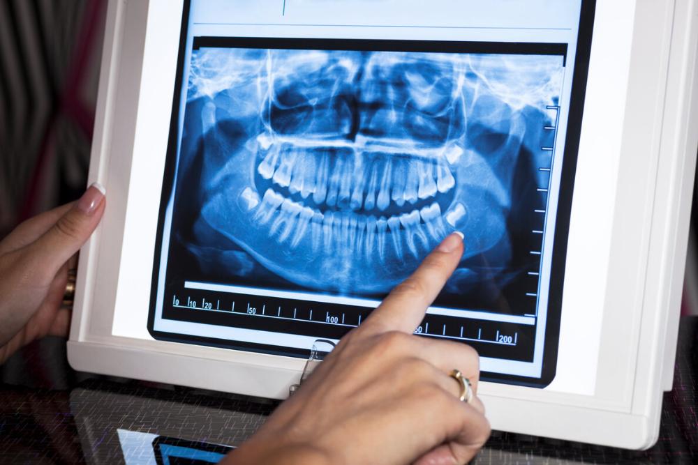 digital x-ray