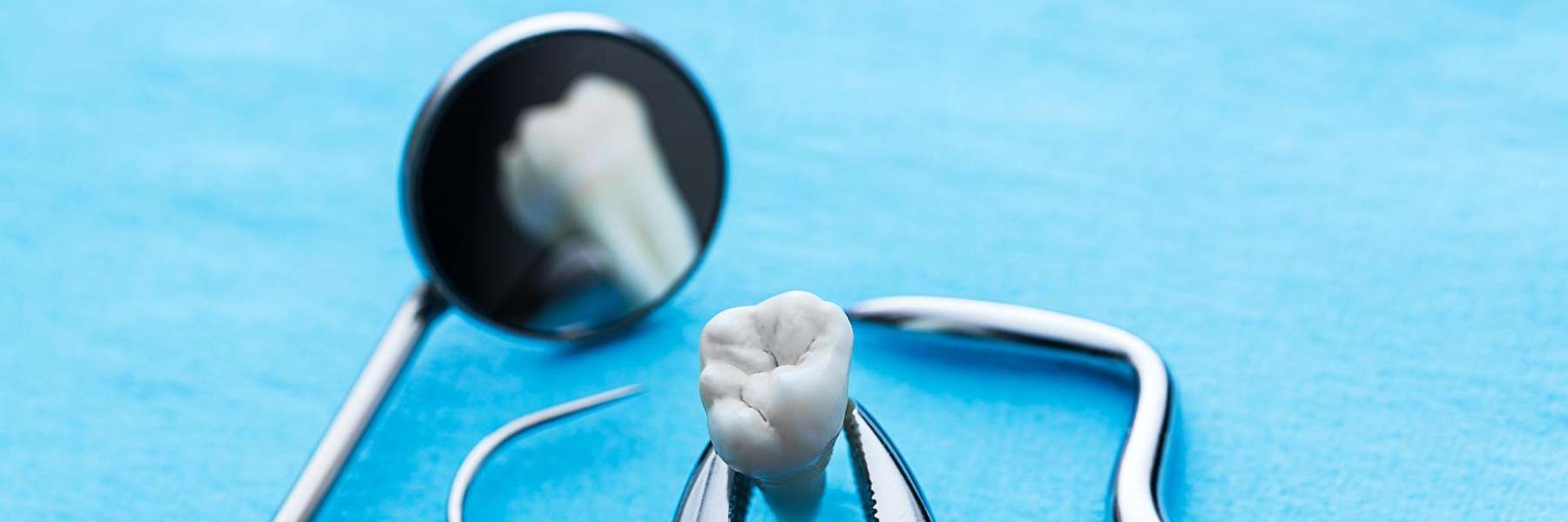 tooth extraction winston salem nc