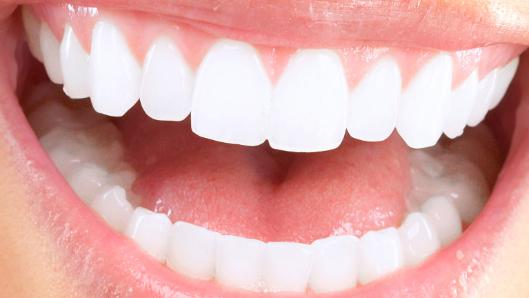 Cosmetic Dentist | Jeffrey J. Tibbs, DDS PA