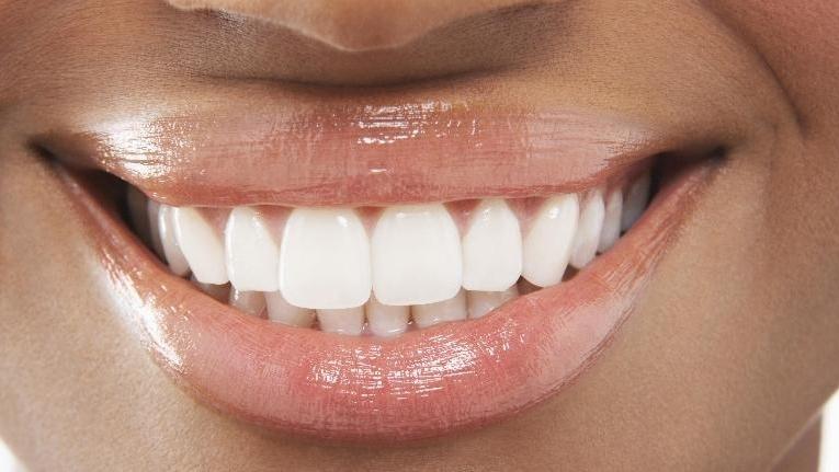 Smile Makeovers in Winston-Salem | Jeffrey J Tibbs DDS PA