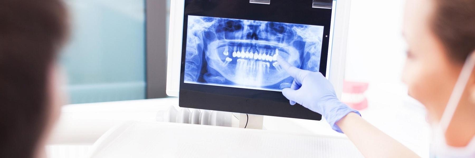panoramic x-ray example