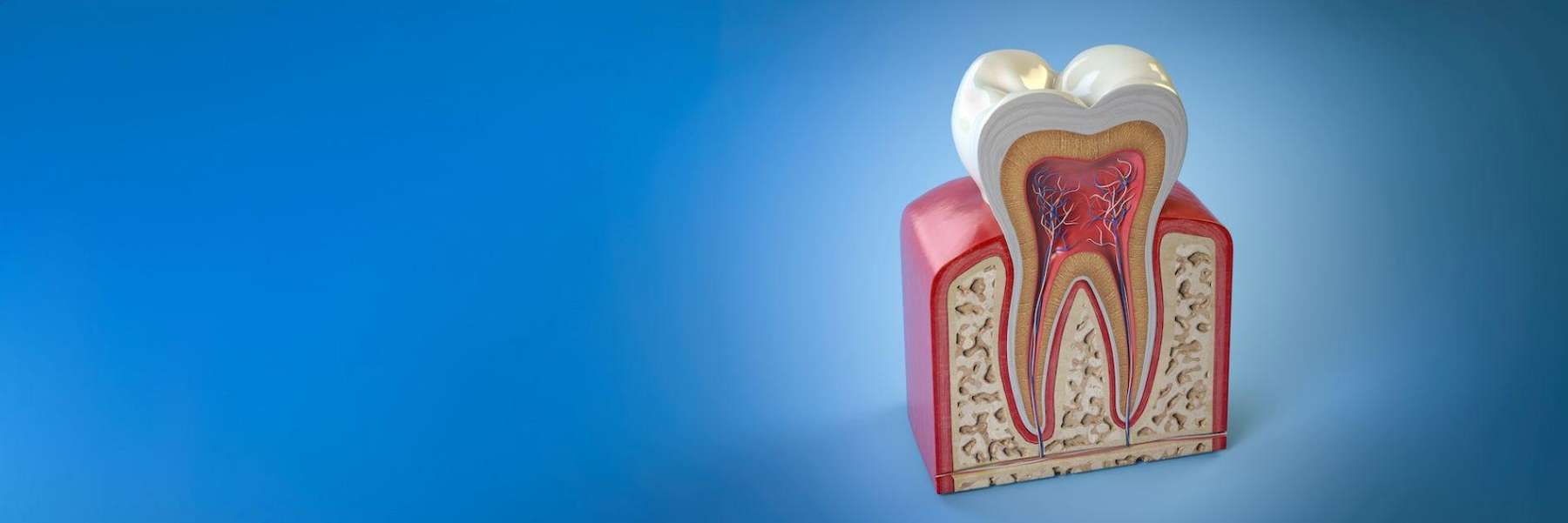 root canal illustration